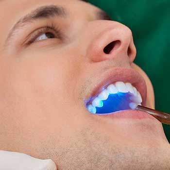 Sandstone Dental | North Calgary Dentist | Cosmetic Tooth Bonding
