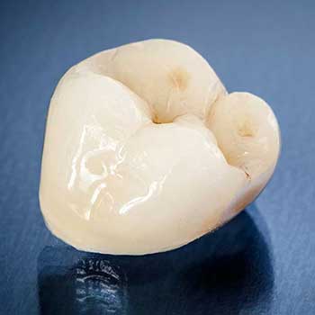 Sandstone Dental | North Calgary Dental Crowns