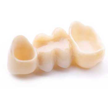 Sandstone Dental | North Calgary Dentist | Dental Bridges