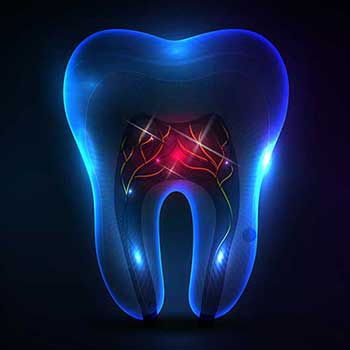 Sandstone Dental | North Calgary Dentist Root Canal Therapy