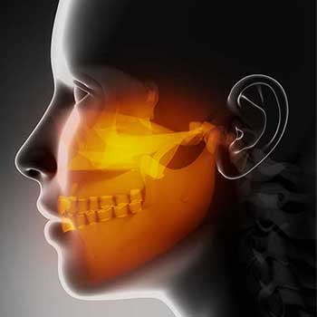 Sandstone Dental | North Calgary TMJ Jaw Pain Treatment