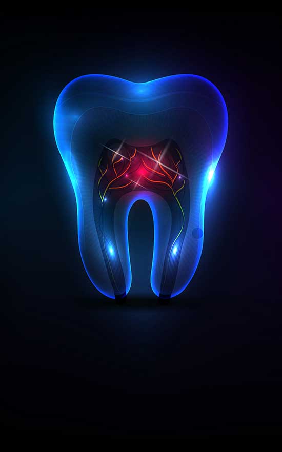 root canal therapy in nw calgary