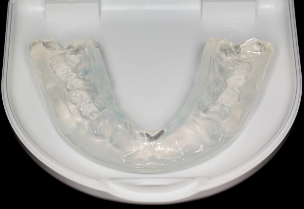 clear aligners - Invisalign