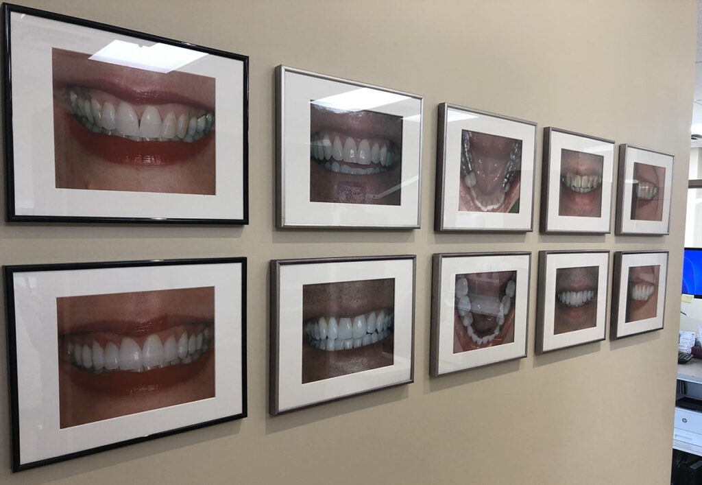 Dentist in NW Calgary Dentist Near You Sandstone Dental